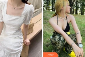貴陽麗都醫(yī)療美容醫(yī)院孫振東整形價格表附隆胸手術案例展示