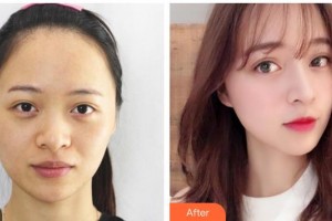 運城市皮膚病醫(yī)院醫(yī)學美容科邢俊蘭整形價格表附激光祛斑案例展示