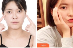 運城愛爾眼科醫(yī)院姜劍整形價格表附開內眼角案例展示