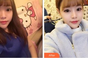 臨汾堯都恒信齒科診所付善民整形價(jià)格表附金屬托槽矯正案例展示