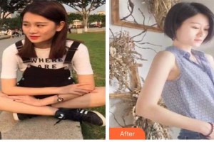 包頭麗人婦產醫(yī)院醫(yī)學美容科李木子整形價格表附清潔祛痘案例展示