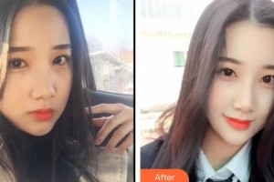 包頭貝特瑞爾口腔門診部劉金龍整形價(jià)格表附冷光美白案例展示