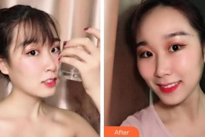 長春欣雅口腔門診部閻華整形價格表附牙齒隱形矯正案例展示