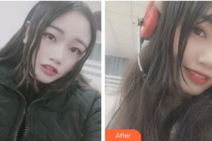 ?？诤佳谰S信口腔門(mén)診部方略宇整形價(jià)格表附牙齒隱形矯正案例展示