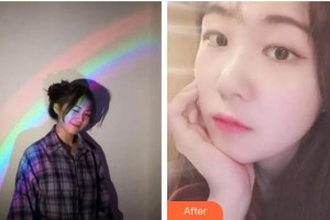 ?？诤佳谰S信口腔門(mén)診部曾婷整形價(jià)格表附超聲波潔牙案例展示