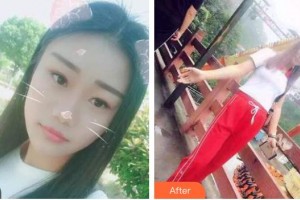 ?？谕？谇婚T(mén)診部陳新整形價(jià)格表附美白貼片案例展示