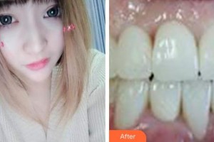 ?？诘露骺谇婚T(mén)診部喬磊整形價(jià)格表附超聲波潔牙案例展示