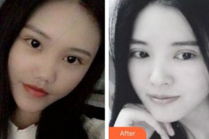 ?？诩t妝尚醫(yī)療美容門(mén)診部趙麗萍整形價(jià)格表附眼部綜合案例展示