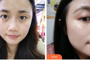 ?？诩t妝尚醫(yī)療美容門(mén)診部姚志文整形價(jià)格表附激光美膚激光案例展示