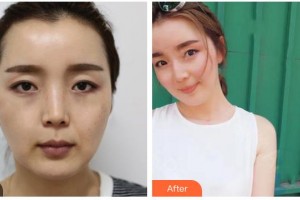 ?？诩t妝尚醫(yī)療美容門(mén)診部郭理霖整形價(jià)格表附熱拉提案例展示