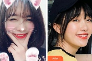 荊州公安縣楚星口腔門診黎燕整形價(jià)格表附冷光美白案例展示