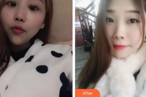 荊州沙市區(qū)楚星口腔門診部黃毅整形價(jià)格表附自鎖托槽矯正案例展示