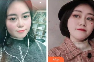 孝感歐陽整形美容診所嚴(yán)飛整形價格表附埋線提升案例展示