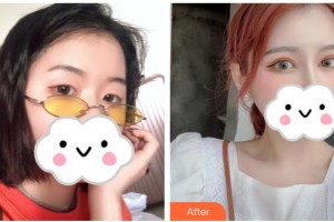 武漢佰視達(dá)眼科門診部林曉冬整形價格表附眼部綜合案例展示