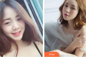 十堰愛(ài)爾眼科醫(yī)院王曙亮整形價(jià)格表附眼部綜合案例展示