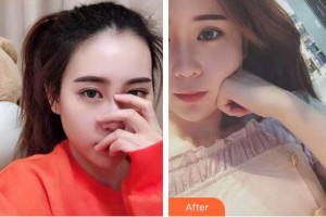 襄陽牙牙口腔門診部馬煥整形價格表附牙齒隱形矯正案例展示