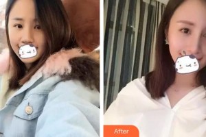 九江風華醫(yī)療美容門診部李風華整形價格表附膨體隆鼻案例展示