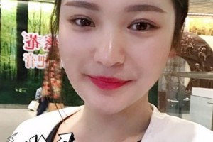 贛州啟明星眼科醫(yī)院欒麗娟整形價格表附眼部綜合案例展示