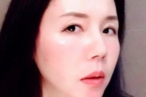 贛州衛(wèi)華口腔醫(yī)院巫資雄整形價(jià)格表附牙綜合案例展示