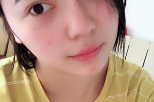 贛州立勤口腔門診部劉飛整形價(jià)格表附牙齒矯正案例展示