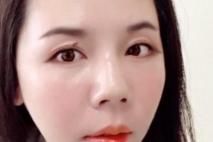 贛州何勤口腔診所何勤整形價(jià)格表附牙齒矯正案例展示