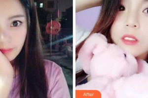 上饒維樂陽光口腔門診部梅健整形價(jià)格表附牙齒隱形矯正案例展示