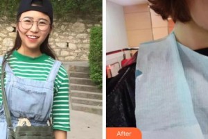上饒維樂陽光口腔門診部楊唐文整形價(jià)格表附牙齒陶瓷矯正案例展示