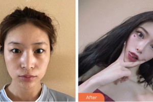 婁底德美醫(yī)療整形美容診所陳貴南整形價(jià)格表附眼部綜合案例展示