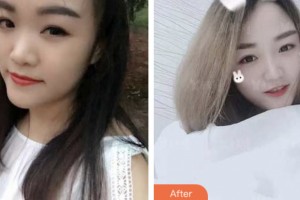婁底德美醫(yī)療整形美容診所董林先整形價(jià)格表附鼻部綜合案例展示