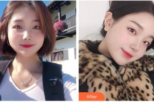 泰州麗都醫(yī)療美容醫(yī)院許俊平整形價格表附耳軟骨復(fù)合隆鼻案例展示