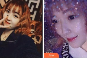 永州國斌口腔門診部李國斌整形價(jià)格表附超聲波潔牙案例展示