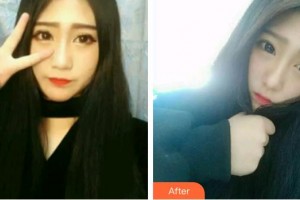 天水市中西醫(yī)結(jié)合醫(yī)院口腔頜面外科高小平整形價格表附牙齒隱形矯正案例展示