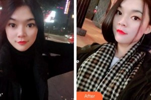 天水瑪莉亞（原女子）醫(yī)院醫(yī)學(xué)整形中心石正平整形價格表附牙齒隱形矯正案例展示