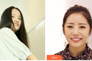 天水市中西醫(yī)結(jié)合醫(yī)院口腔頜面外科盧軍勝整形價格表附牙齒隱形矯正案例展示