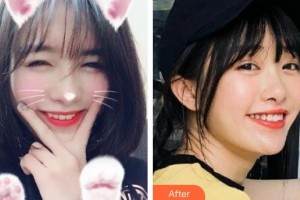 天水市中西醫(yī)結(jié)合醫(yī)院口腔頜面外科丁艷美整形價格表附冷光美白案例展示
