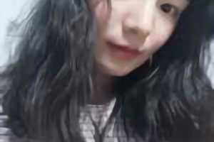 北京圣嘉榮醫(yī)療美容醫(yī)院磨骨好不好？附黃大勇磨骨案例