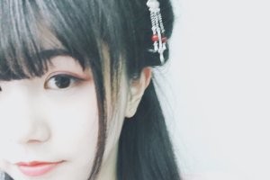 南昌時(shí)光醫(yī)療美容門(mén)診部隆鼻手術(shù)全過(guò)程展示 附果圖