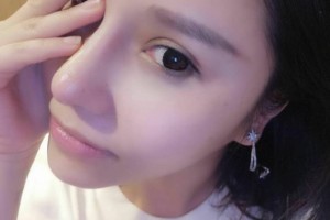 同濟大學附屬東方醫(yī)院醫(yī)生團隊如何？附隆鼻手術附果圖展示