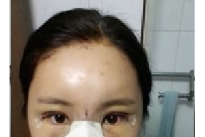 上海大附屬九院整形科如何？附實(shí)拍案例+醫(yī)生介紹
