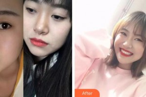 八大處整形醫(yī)院國貿門診部呂唯整形價格表附牙齒隱形矯正案例展示