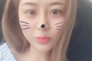 鄭州大學第五附屬醫(yī)院董琪隆鼻手術(shù)果好不好附案例分享和價格表
