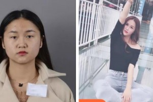 咸陽彩虹醫(yī)院整形美容科羅曼整形價(jià)格表附切開雙眼皮案例展示