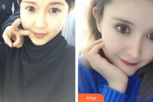 瑞安雅正口腔門診部吳奕坤整形價格表附牙齒陶瓷矯正案例展示
