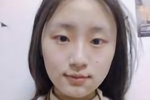 北京圣嘉榮醫(yī)療美容醫(yī)院口碑怎么樣？附案例分享|醫(yī)生推薦