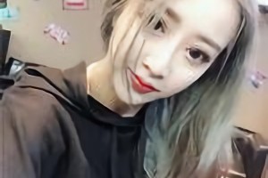 杭州整形醫(yī)院靠譜嗎？附下頜角術后恢復過程圖