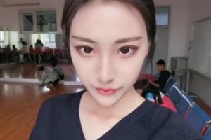 北京圣嘉新醫(yī)院顴骨/術(shù)后恢復(fù)經(jīng)驗+較新價格表