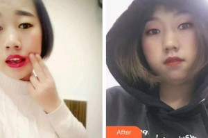 東莞恒生口腔門診部周東風(fēng)整形價(jià)格表附根管調(diào)節(jié)案例展示