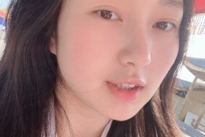 濟(jì)寧附屬醫(yī)院整形科下顎角感覺(jué)怎樣？真人案例圖片對(duì)比