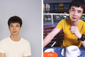 譚筱姍整形價(jià)格表附鼻部綜合案例展示