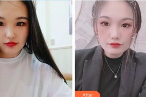 賀斌整形價格表附白瓷娃娃案例展示